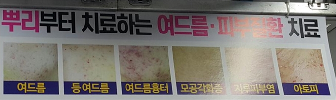 지하철 4호선 객차 내부에 붙어있는 A한의원의 '뿌리부터 치료하는 여드름 피부질환 치료' 광고. 관할 보건소는 "의료법 위반 소지가 있는 문구"라며 행정조치를 했다고 밝혔다.  ⓒ의협신문