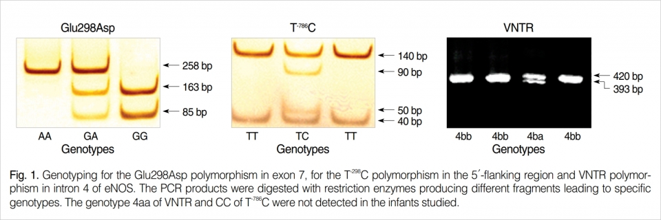 [그림 1] eNOS의 인트론 4의 5'- 측부영역에서의 T-298C 다형성 및 VNTR 다형성에 대한 엑손 7의 Glu298Asp 다형성에 대한 유전자형 분석이다. PCR 산물은 특정 유전자형을 유발하는 상이한 단편을 생성하는 제한 효소로 분해되었다. VNTR의 유전자형 4aa 및 T-786C의 CC는 연구된 영아에서 검출되지 않았다.