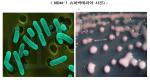국내 연구진, 슈퍼박테리아 세계 최초 규명