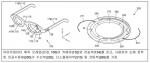 각막혼탁 시력회복 돕는 '시각보조장치' 특허