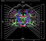 가천대 연구소 세계 첫 '뇌신경 지도' 제작