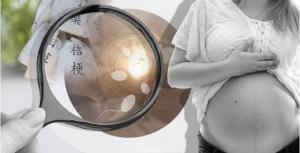 한방난임치료?…난임여성 자연임신율 절반 수준