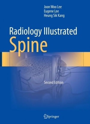 [Radiology Illustrated: Spine] 2판