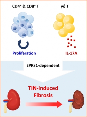 '신세뇨관 간질염' 주요 매개체...단백질 합성효소 'EPRS1'